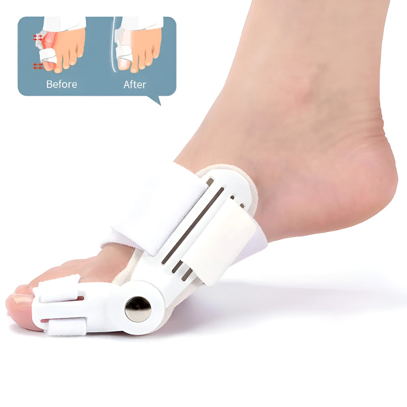 Bunion Splint and Big Toe Straightener – Orthopedic Hallux Valgus Corrector for Foot Pain Relief & Pedicure Care