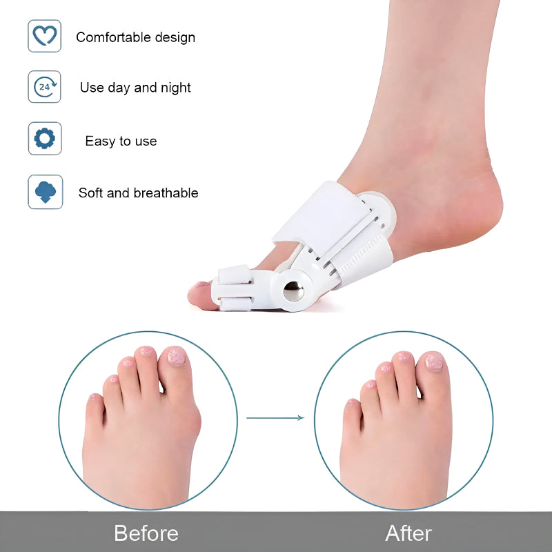 Bunion Splint and Big Toe Straightener – Orthopedic Hallux Valgus Corrector for Foot Pain Relief & Pedicure Care